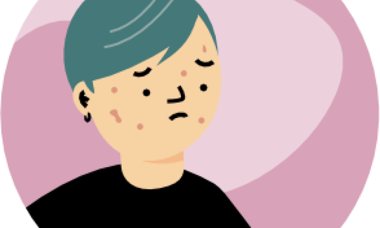 Mind Over Mirror - young person with acne